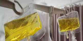 Sarı Serum Hakkında Sağlık Bakanlığı Açıklaması sar-serum-hakknda-salk-bakanl-aklamas